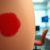 Kiedy rumień wymaga wizyty u dermatologa – sygnały ostrzegawcze i przebieg konsultacji